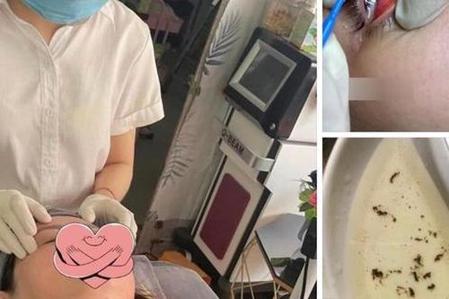 Dịch vụ bắt 'sâu mắt', 'sán mắt' tại các spa khiến nhiều chị em hứng thú, chuyên gia cảnh báo 3 sự thật