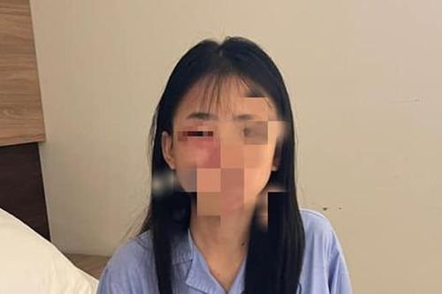 Hà Nội: Nữ sinh lớp 8 bị đánh hội đồng phải nhập viện