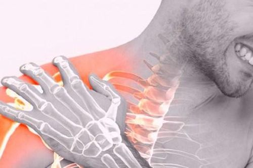 5 bài tập khắc phục cơn đau do viêm quanh khớp vai