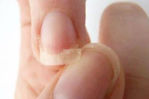 Những dấu hiệu cơ thể bạn đang thiếu hụt canxi trầm trọng
