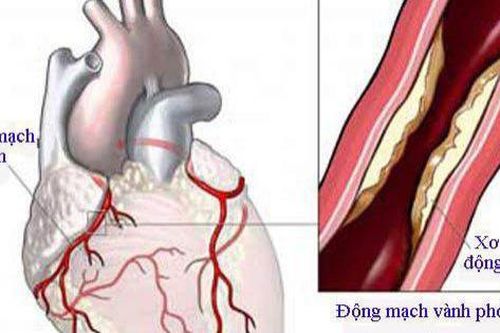 Đường ruột tác động đến sức khỏe tim mạch như thế nào?