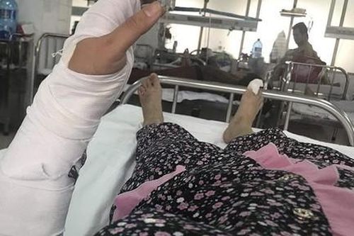 Điều tra vụ chồng đánh vợ dã man phải cấp cứu