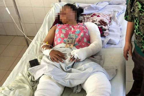 Mẹ kế tẩm xăng đốt cả nhà, 4 người bị thương
