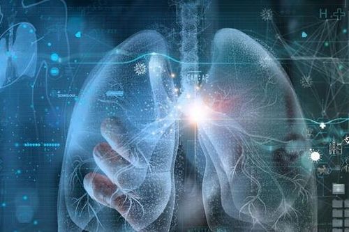 Phát hiện sớm các dấu hiệu ung thư phổi bằng trí tuệ nhân tạo