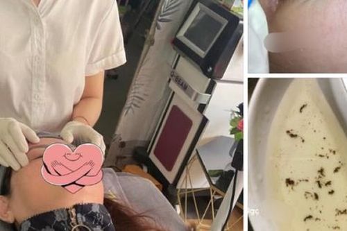 Nở rộ dịch vụ bắt sâu mắt trên mạng xã hội, chuyên gia y tế cảnh báo nguy cơ hỏng mắt