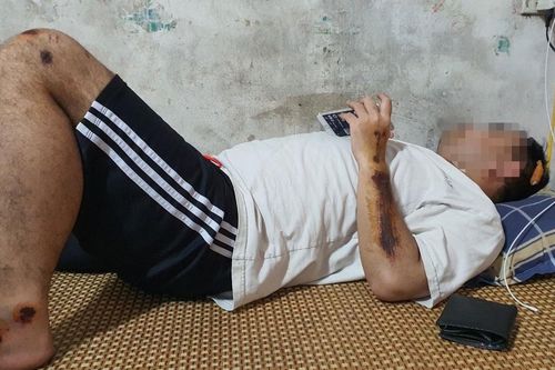Bắt giữ 2 nghi phạm vụ hô 'chém chết' ở Hà Nội