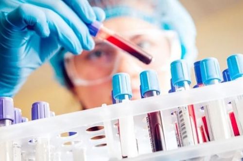 38 đơn vị hết hạn chứng nhận năng lực xét nghiệm SARS-CoV-2 năm 2023