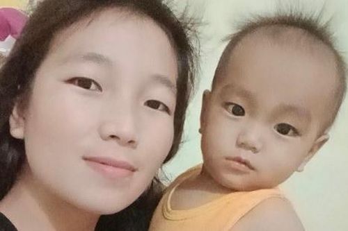Người phụ nữ trẻ bị bỏng nặng nguy kịch