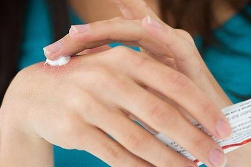 Cách dùng thuốc corticoid tại chỗ trị viêm da cơ địa