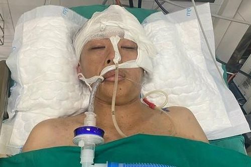 Góa phụ tàn tật tuyệt vọng vì con trai tai nạn chấn thương sọ não