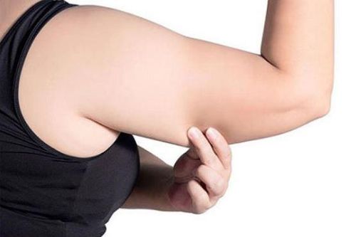Bí quyết giảm mỡ thừa ở bắp tay ngay tại nhà