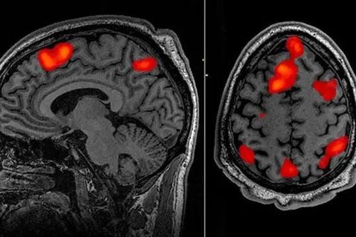 AI có thể đọc suy nghĩ và biến nó thành văn bản?