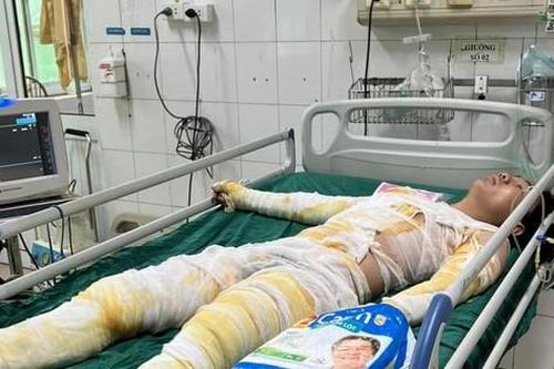 MS 843: Xót thương cậu bé mồ côi cha giờ có nguy cơ cưa bỏ chân vì tai nạn