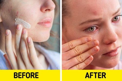 Loạt sản phẩm chăm sóc da phổ biến có thể gây hại nhiều hơn lợi