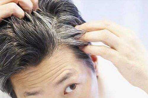 Những nguyên nhân khiến tóc bị bạc sớm