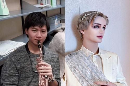 Chàng trai Nhật Bản lộ mặt quái dị, phủ nhận 'dao kéo' quá đà