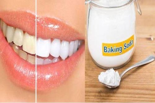 Bí quyết làm răng trắng tại nhà với baking soda