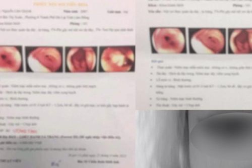 Xôn xao cô gái sử dụng bệnh án của người khác để tạo nên câu chuyện tình 'ung thư sắp chia lìa'