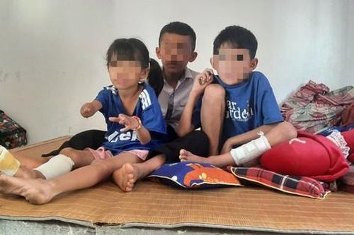 Sức khỏe của 3 nạn nhân nhỏ tuổi trong vụ nổ kinh hoàng tại Nghệ An sau hơn 1 tháng điều trị
