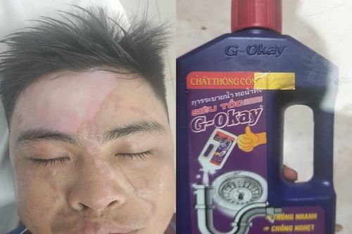 Dùng nước thông cống siêu tốc, nhiều người bỏng phải nhập viện cấp cứu