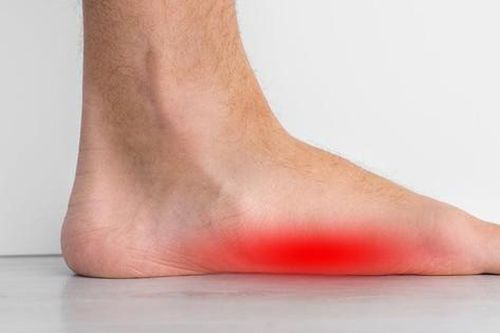 Bàn chân bẹt ở trẻ: Dị tật phổ biến nhưng ít cha mẹ quan tâm