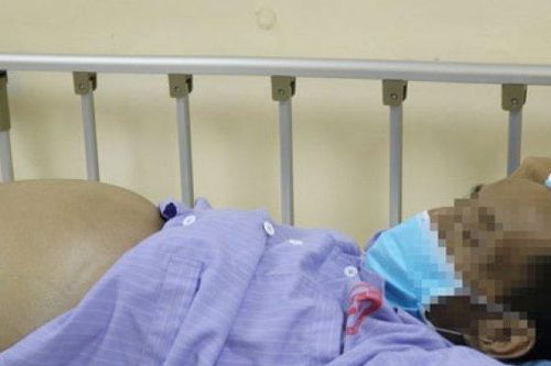 Người đàn ông nhập viện cấp cứu vì tự ý điều trị xơ gan