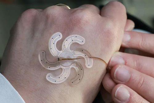 Điện cực hình bông hoa mở ra khả năng phẫu thuật não điều trị thần kinh với xâm lấn tối thiểu