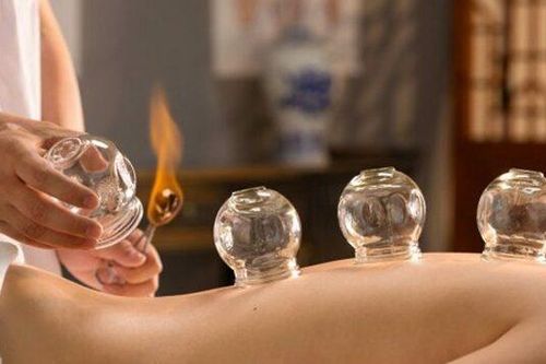 Ai không nên giác hơi, cần tránh điều gì?