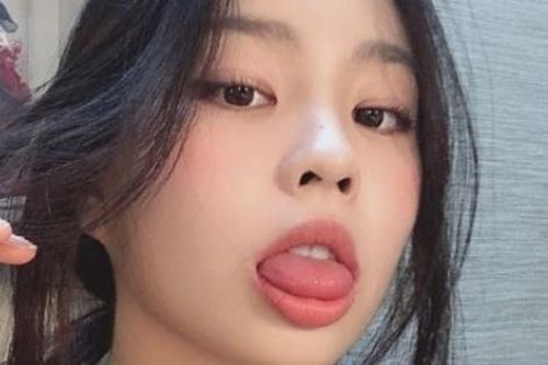 7 bất thường ở lưỡi đang tố cáo bệnh tật, thậm chí là ung thư nhưng ít ai để ý
