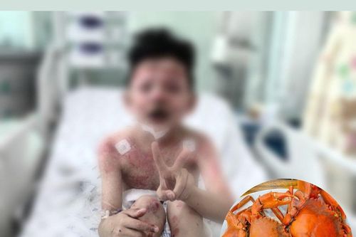 Sau 2 ngày ăn cua, bé trai nguy kịch