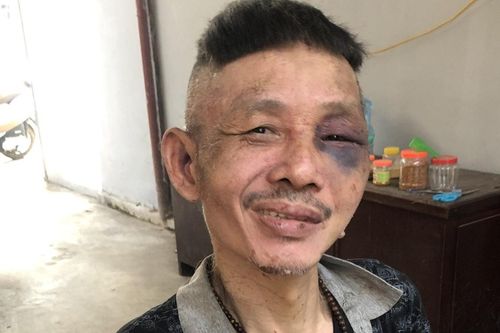 Bắt giữ đối tượng nghi ngáo đá, thường xuyên quậy phá hàng xóm
