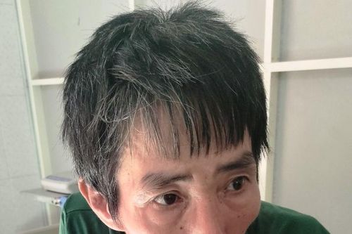 Người đàn ông say rượu dùng điếu cày tấn công lực lượng công an