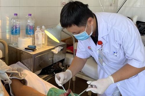 Nối thành công ba ngón tay bị đứt lìa do tai nạn lao động