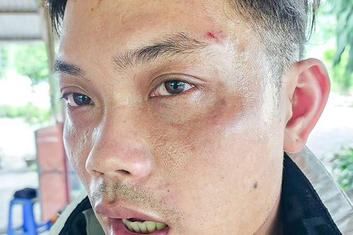 Làm việc với nhóm thanh niên bị tố đánh du khách ở Nha Trang