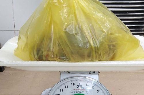 Phẫu thuật thành công khối U khổng lồ nặng gần 7kg