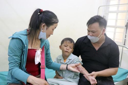 Điện Biên: 168 trẻ em khuyết tật được phẫu thuật miễn phí