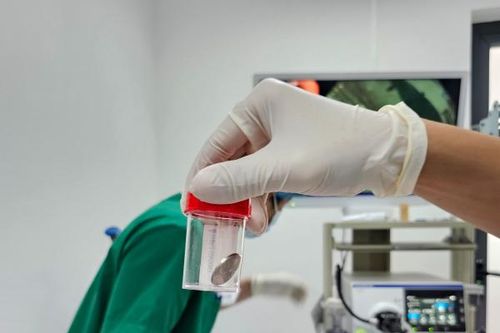 Bệnh viện 22-12: Gắp dị vật thành công cho trẻ 6 tuổi