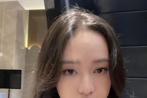 'Hot girl thị phi' Thúy Vi giờ ra sao sau can thiệp thẩm mỹ?