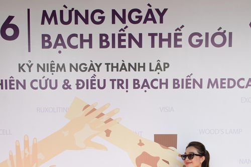 Á hậu Lệ Hằng chia sẻ cùng bệnh nhân trong ngày 'Bạch biến thế giới'