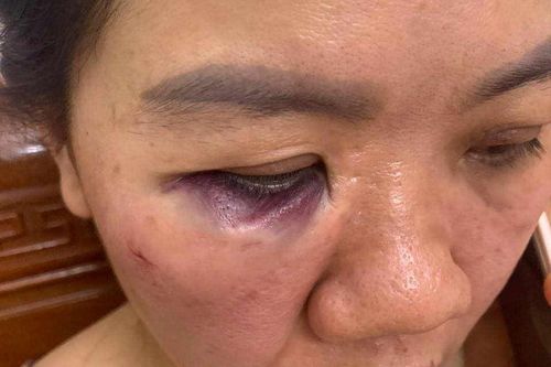 Nữ cán bộ Điện lực ở Hà Tĩnh bị đồng nghiệp tấn công