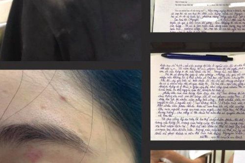 Vụ nhân viên quán bánh mì Nguyên Sinh bị tố hành hung khách: Sẽ giám định thương tích của khách