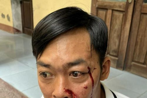 Điều tra vụ người đàn ông bị hành hung sau khi rời Tòa án ở Huế