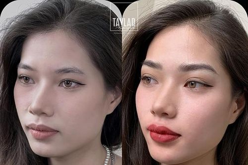 Xu hướng thêu chân mày an toàn, hiệu quả lại không gây đau đớn