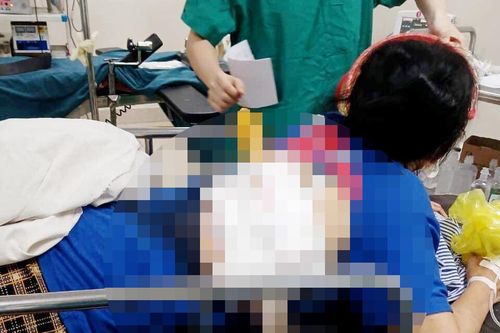Mâu thuẫn, chồng ném dao đâm xuyên lưng vợ