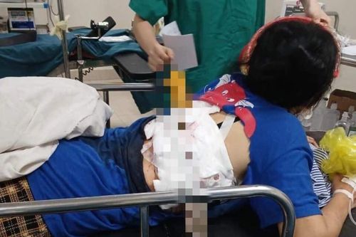 Sức khỏe người vợ bị chồng phóng dao xuyên lưng thế nào?