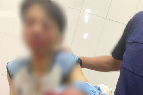 Sau tiếng nổ lớn, nam sinh ở Hà Tĩnh dập nát bàn tay