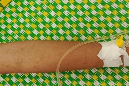 Dùng dao lam rạch trên người để chữa bệnh, bé gái 11 tuổi nguy kịch