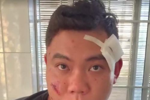 Khánh Hòa: Bắt tạm giam nghi phạm nổ súng khiến 2 người bị trúng đạn