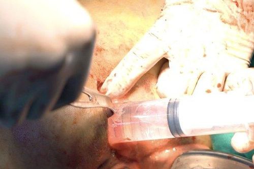 Cảnh báo biến chứng do làm đẹp tại cơ sở không phép