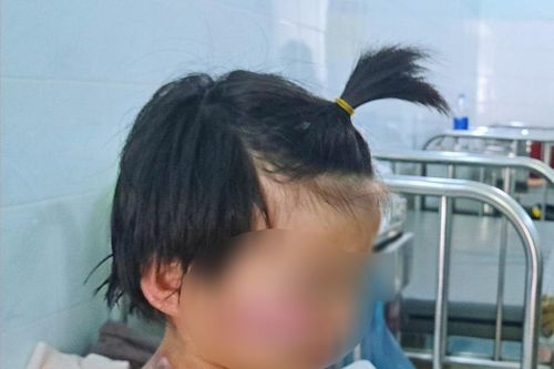 Sức khỏe 4 trẻ mắc kẹt trong vụ cháy nhà ở Tây Ninh hiện ra sao?
